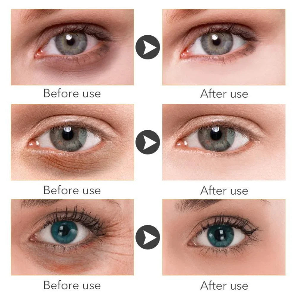 Retinol Anti-aging Whitening Serum-1